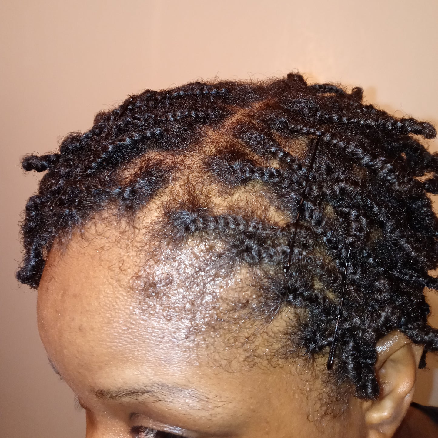 Package Deal (Oil 2 oz Moisturizer 4 oz)