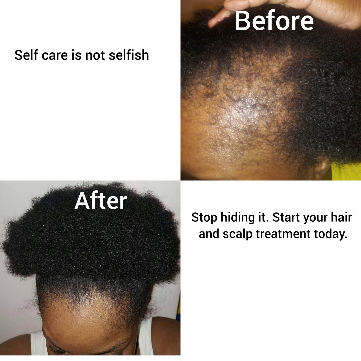 Peppermint Blast Healing Serum For All Hair Types