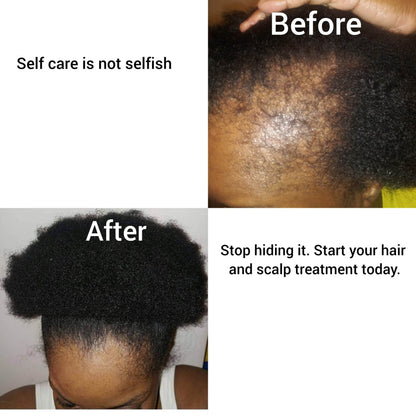 Peppermint Blast Healing Serum For All Hair Types