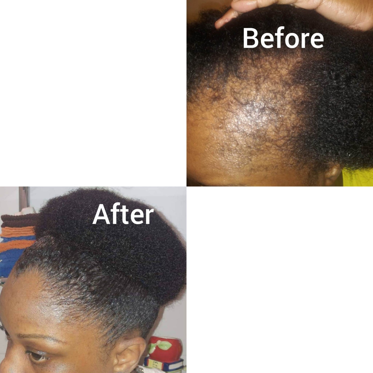 Peppermint Blast Healing Serum For All Hair Types