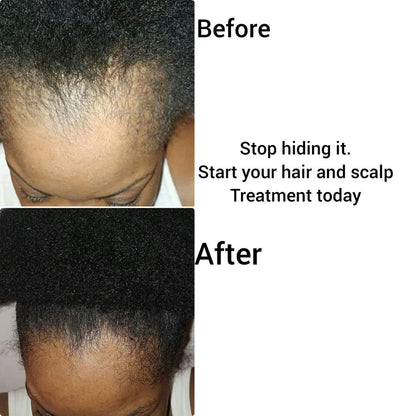 Peppermint Blast Healing Serum For All Hair Types