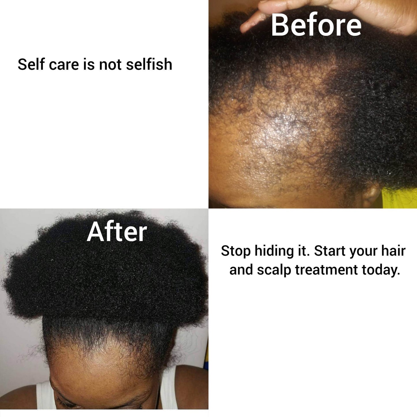 Peppermint Blast Healing Serum For All Hair Types