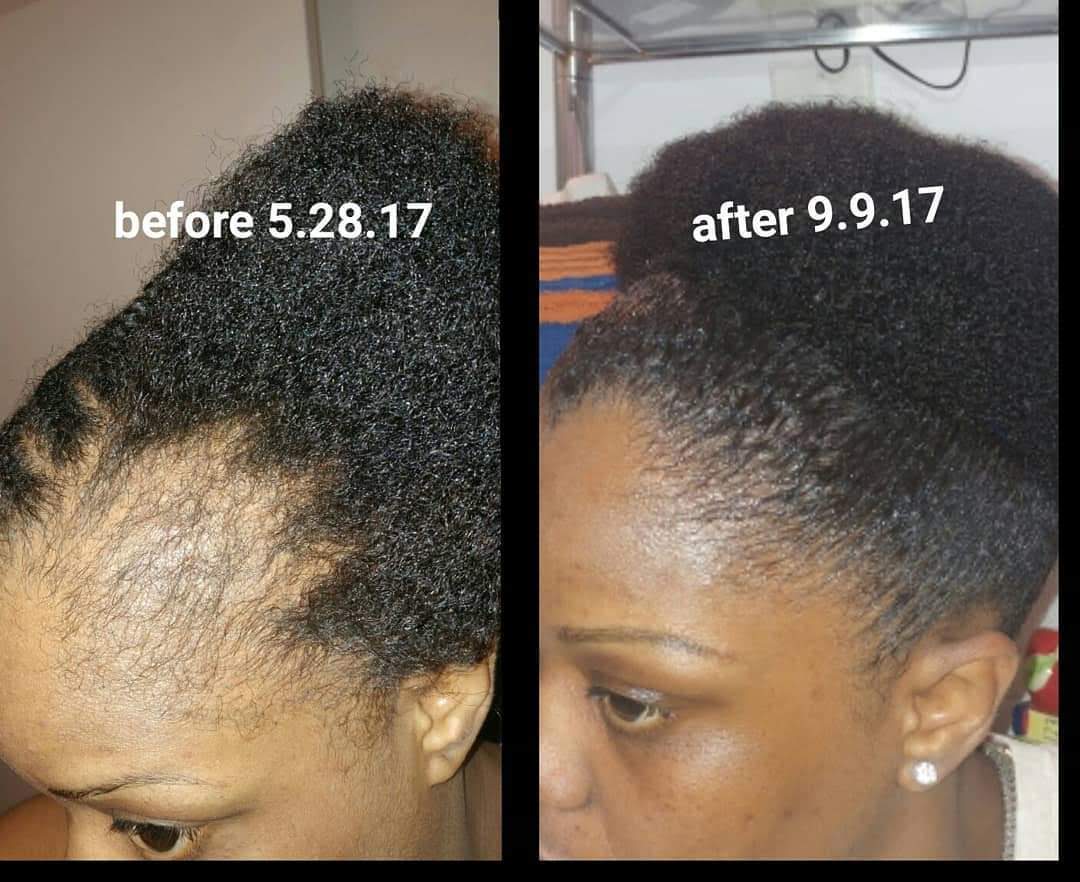 Peppermint Blast Healing Serum For All Hair Types