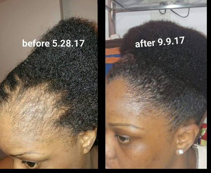 Peppermint Blast Healing Serum For All Hair Types