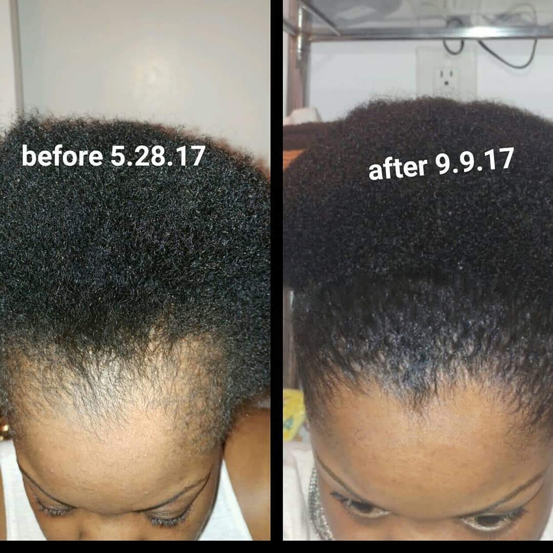 Peppermint Blast Healing Serum For All Hair Types