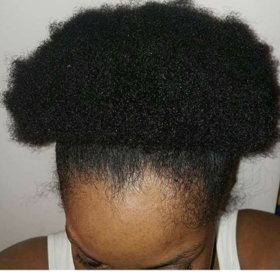 Package Deal  (Oil 2 oz Moisturizer 4 oz)