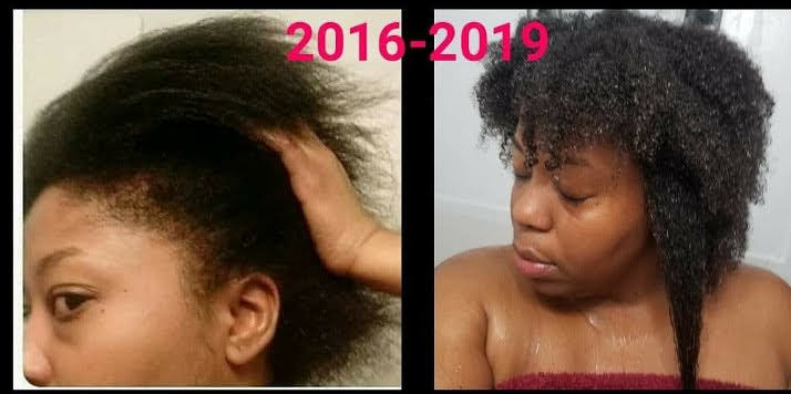 Peppermint Blast Healing Serum For All Hair Types